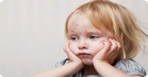 Çocuklarda Kızamık Belirtileri